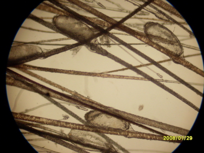 Bild einer Mikroskopierung