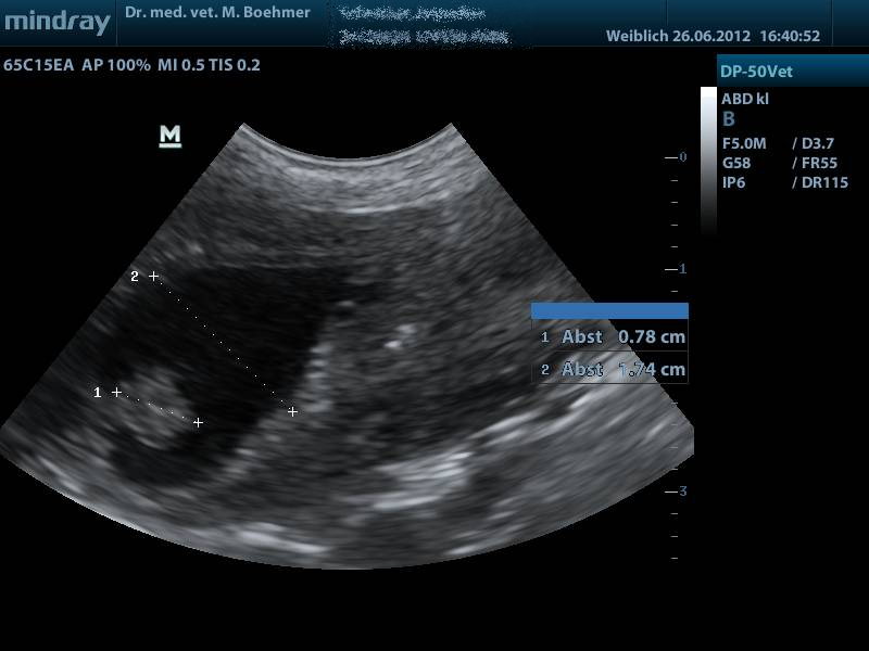 Bild einer Sonographie